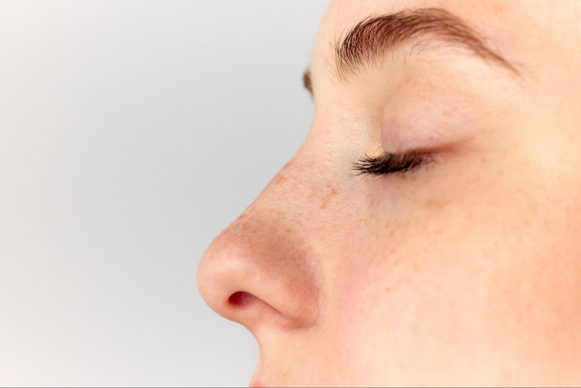 How Rhinoplasty and Sinus Surgery Work Together To Resolve Sinus Blockages